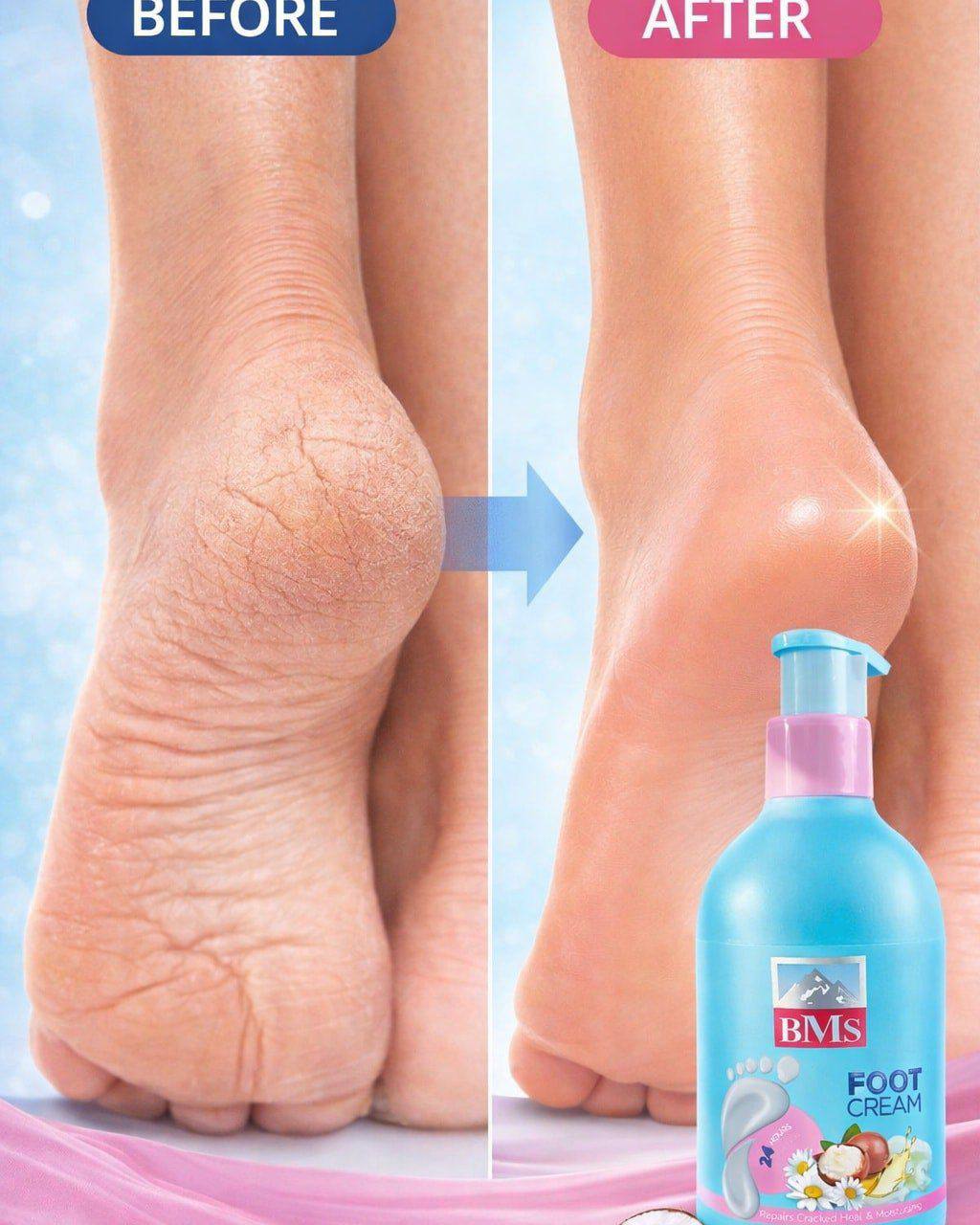 مرطب وكريم القدمين BMS (Foot Cream) المصمم للعناية المتكاملة بالأقدام الجافة والمتشققة