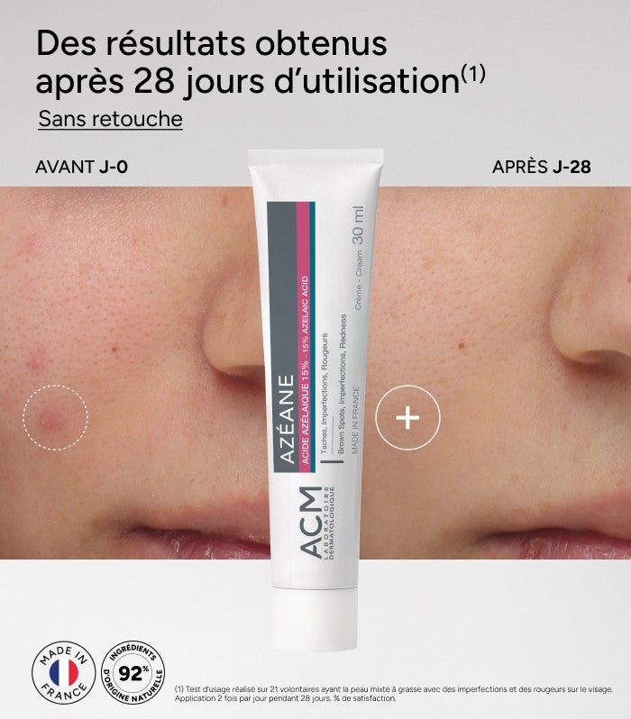 ACM/ Azeane - Azelaic Acid 15% 30ml :كريم ازيان بتركيز 15% الازيلك اسيد من اي سي ام