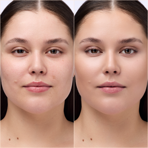 مصحح الهالات السوداء تحت العين من كاتريس (Catrice Under Eye Brightener)