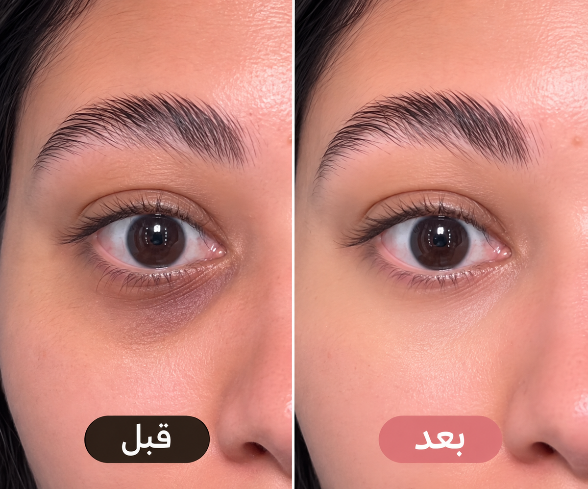 مصحح ومفتح منطقة تحت العين للحنطية وسمره (Catrice Under Eye Brightener Instant Awake)