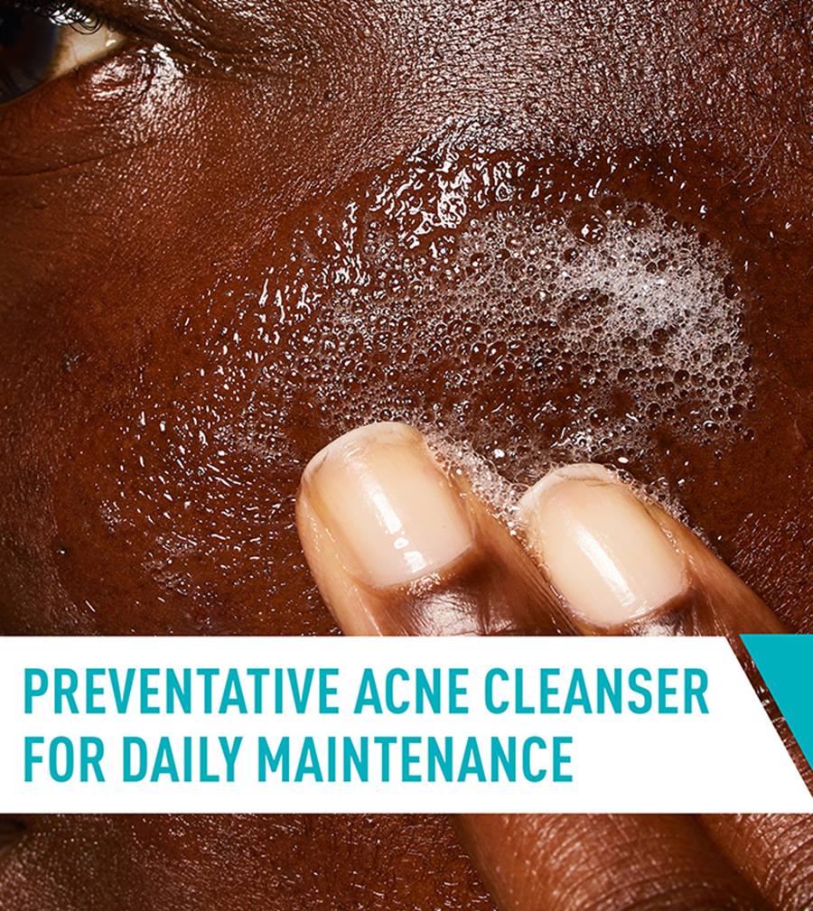 CeraVe Blemish Control Cleanser Face Wash For Acne & Blemish Prone Skin with 2% Salicylic Acid, Niacinamide and Ceramides -236ml | سيرافي غسول لحب الشباب - 236 مل
