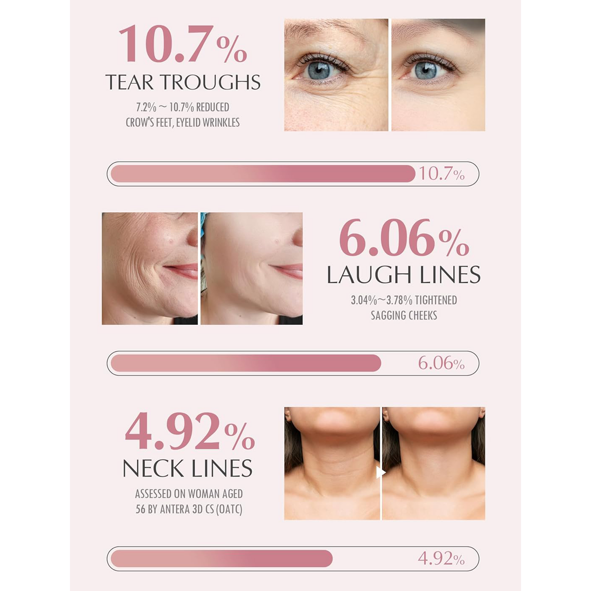 بلسم مرطب كوري شهير مصمم للاستخدام المتعدد على الوجه والرقبة.KAHI Wrinkle Bounce Multi Balm