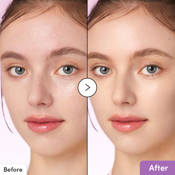 EQQUALBERRY Purple Pdrn Pore Minimizing Serum - 30ml| ايكوال بيري سيروم لتقليل المسام -30 مل
