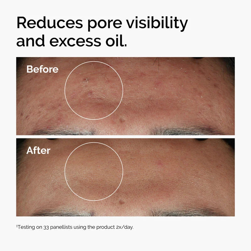 The Ordinary Niacinamide 10% + Zinc 1% - 60ml | ذا أورديناري سيروم نياسيناميد وزنك - 60 مل