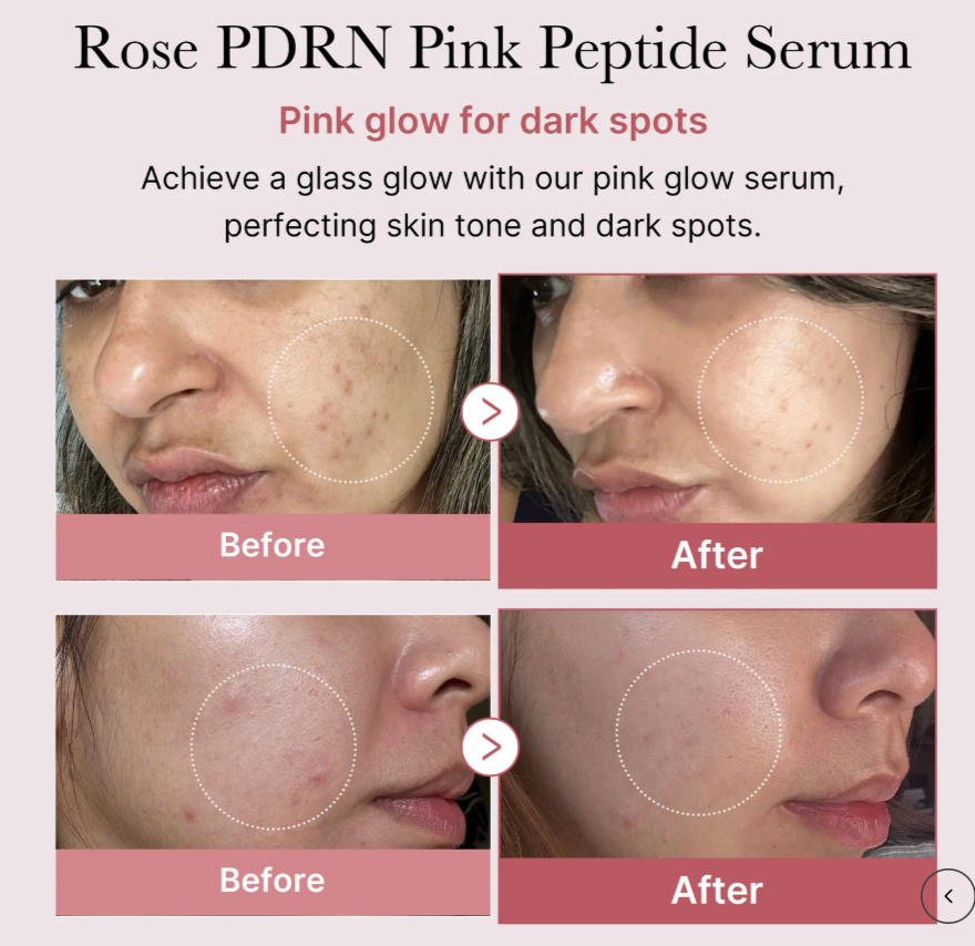 Medicube PDRN PINK PEPTIDE SERUM - 30ML | ميدي كيوب سيروم الببتيدات - ٣٠ مل