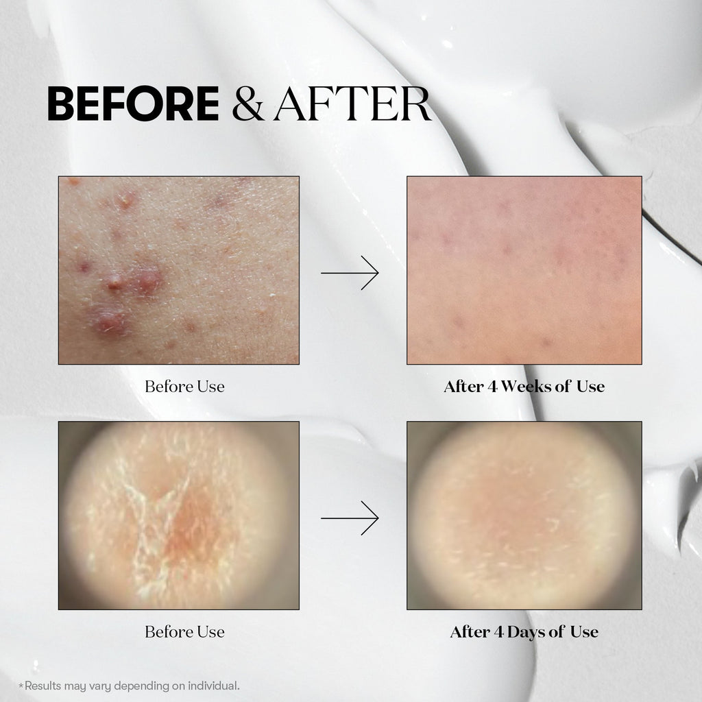 VT Cosmetics Cica Reedle Shot 100، وهو سيروم كوري مبتكر يعتمد على تقنية "الإبر الدقيقة السائلة"