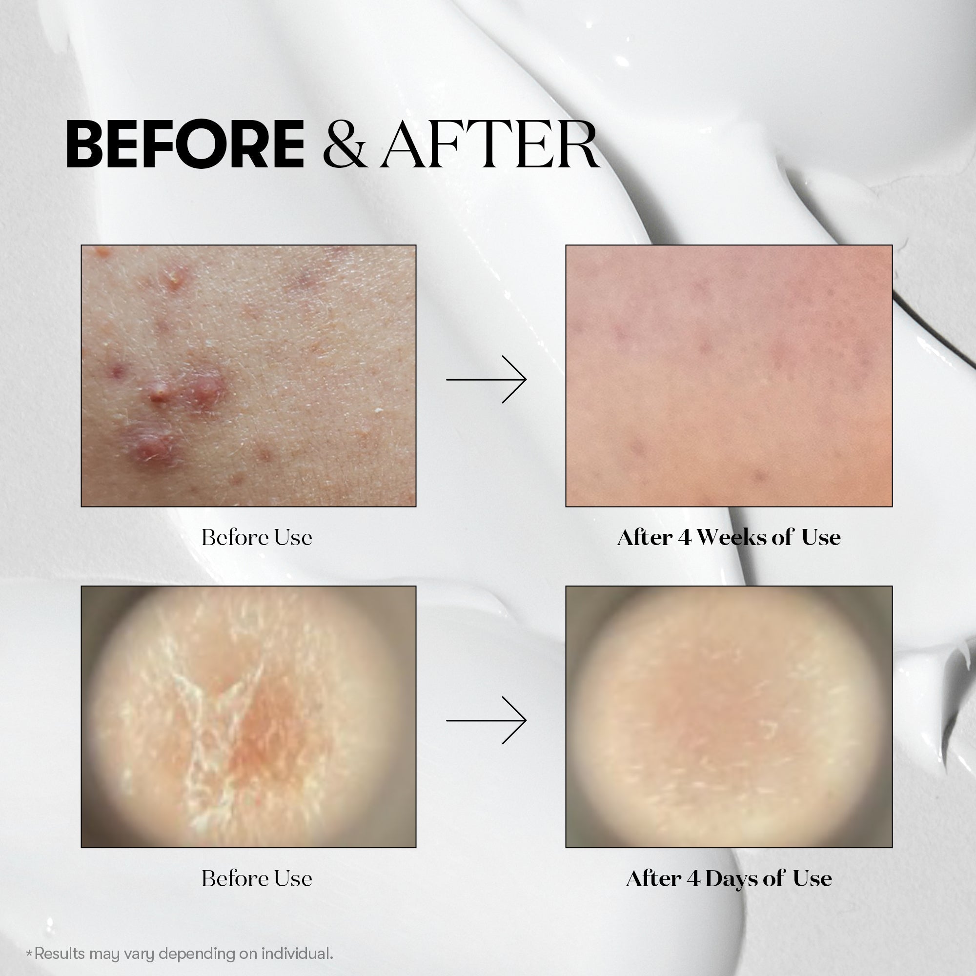 VT Cosmetics Cica Reedle Shot 100، وهو سيروم كوري مبتكر يعتمد على تقنية "الإبر الدقيقة السائلة"